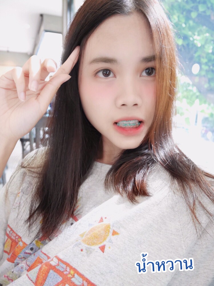UploadImage